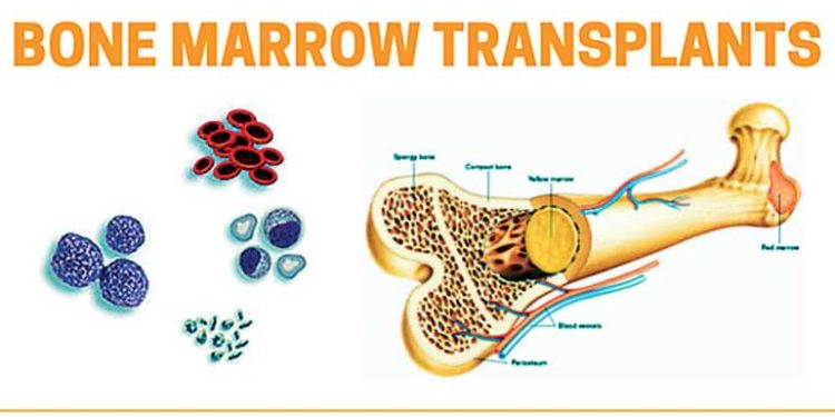 நவீன எலும்பு மஜ்ஜை மாற்று சிகிச்சை பிரிவை அமைப்பதன் மூலம் வாழ்வில் புதிய நம்பிக்கையை அளித்துள்ள நவலோக்க மருத்துவமனை